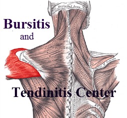 Bursitis and tendinitis badge link